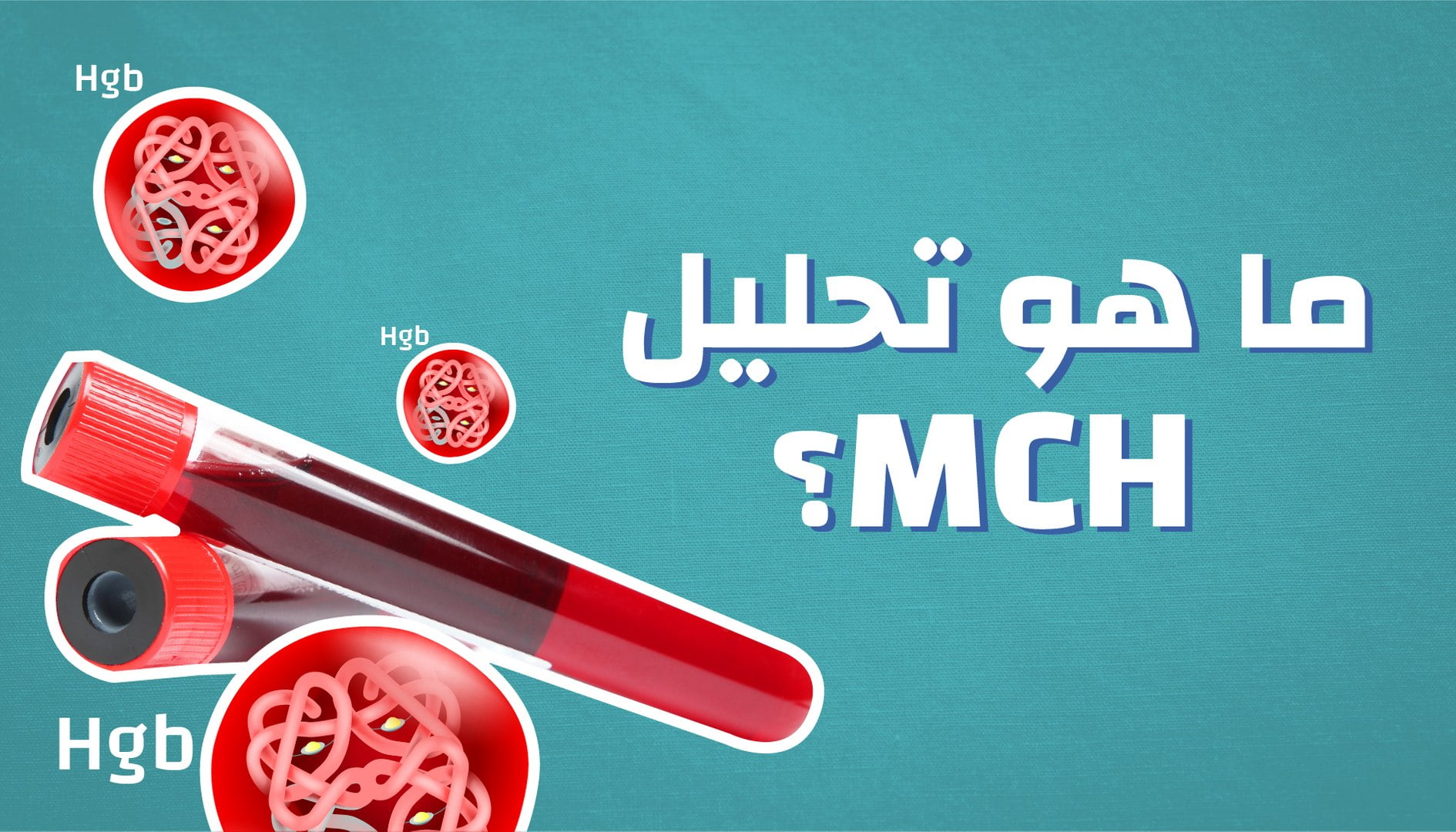 تعرف ماهو تحليل mcv