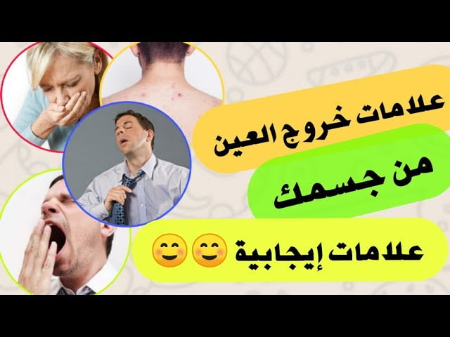 علامات خروج العين والحسد بالحجامه