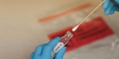 ما هو فحص pcr الخاص بكورونا