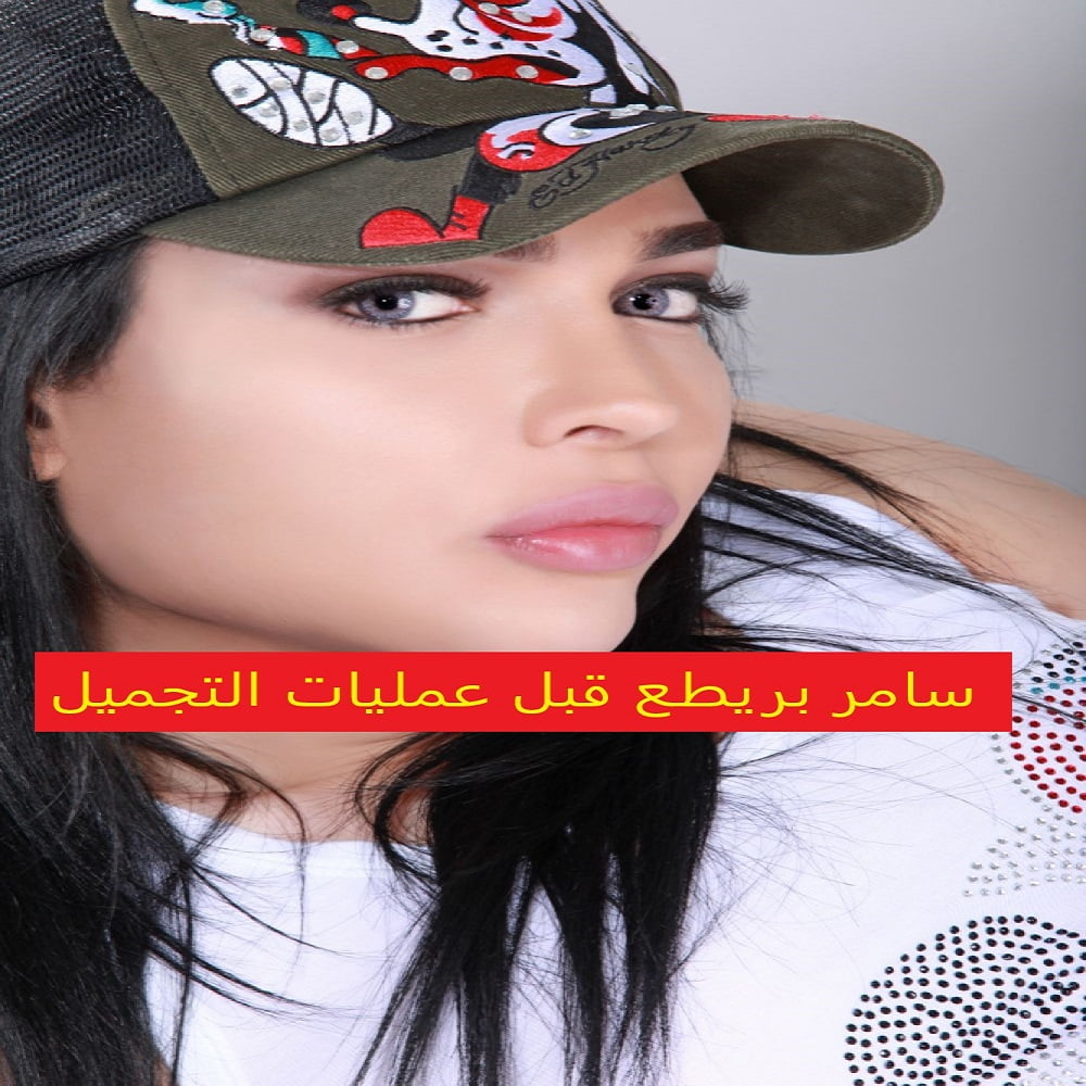 صور سامر بريطع قبل عمليات التجميل